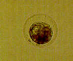 Embryoa.jpg